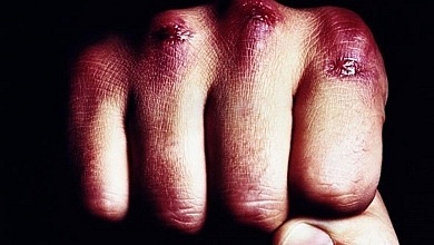 Bruised Fist
