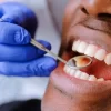 Dental Clinic Patinet Teeth Cleaning